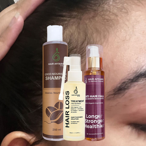 Hair Loss Bundle