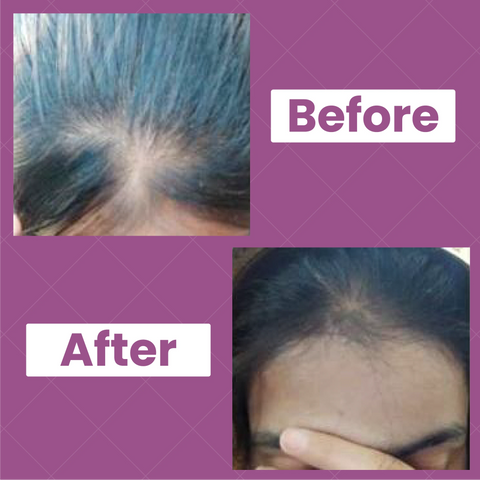 Anti Hair Fall and Hair Growth Oil